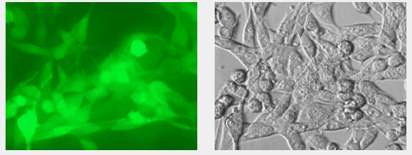 GFP fluorescent image in Mouse MB49 cell line