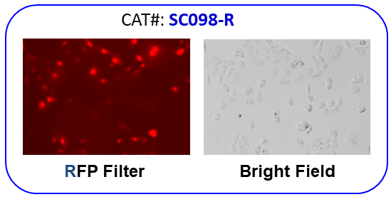 Human NCI-H1650 / RFP cell line image